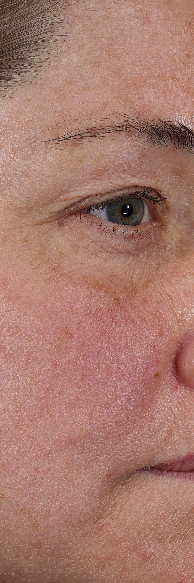 dieux Dieux-close-up-of-skin-around-the-eye-and-cheek-01.