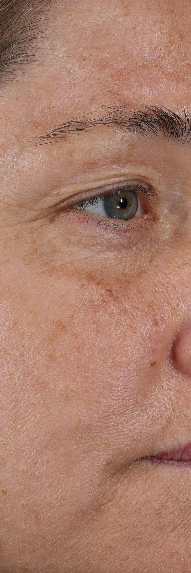 dieux Dieux-close-up-of-the-eye-and-cheek-area-of-a-persons-face-showing-skin-texture.