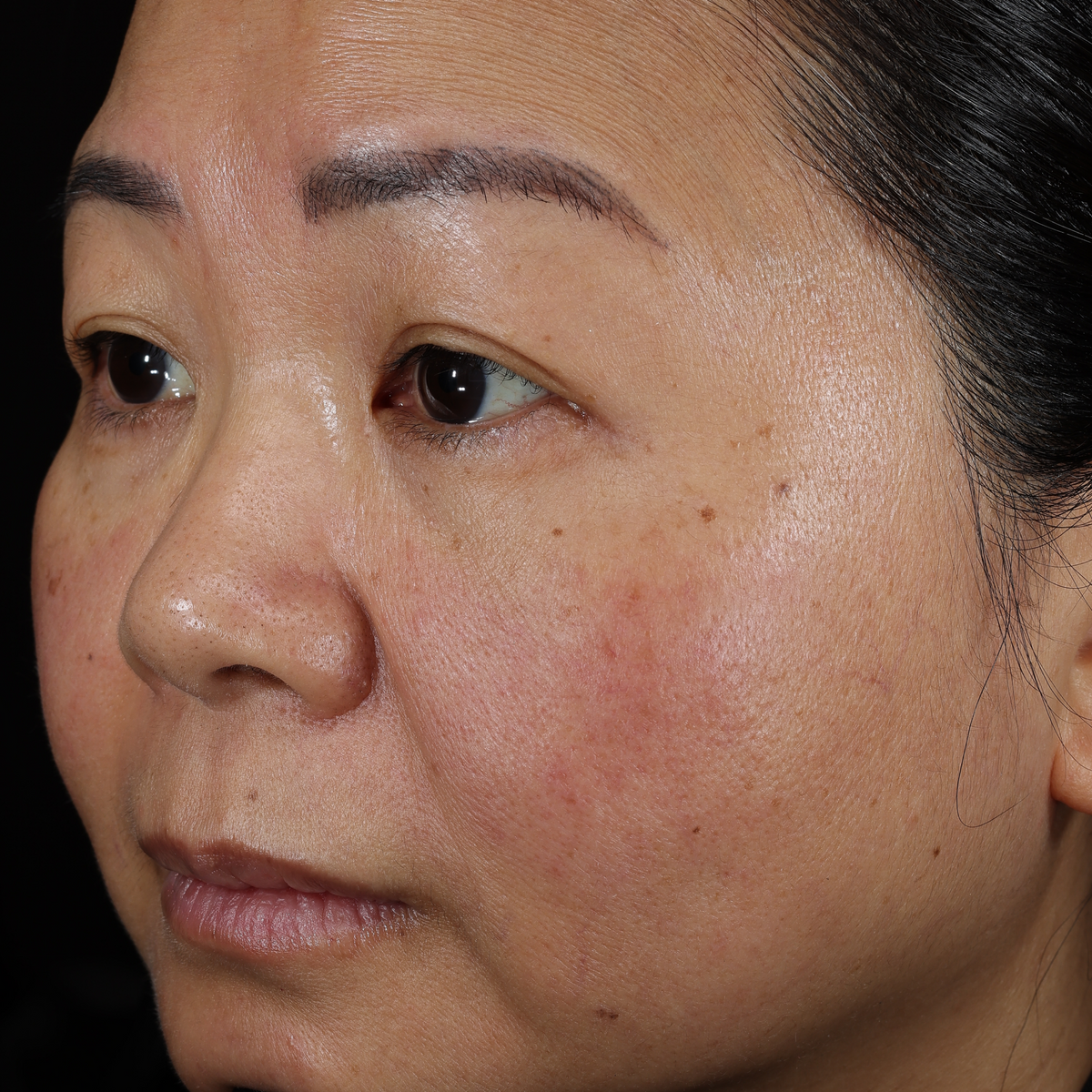 dieux Dieux-close-up-of-a-womans-face-showing-skin-texture-and-discoloration-01.