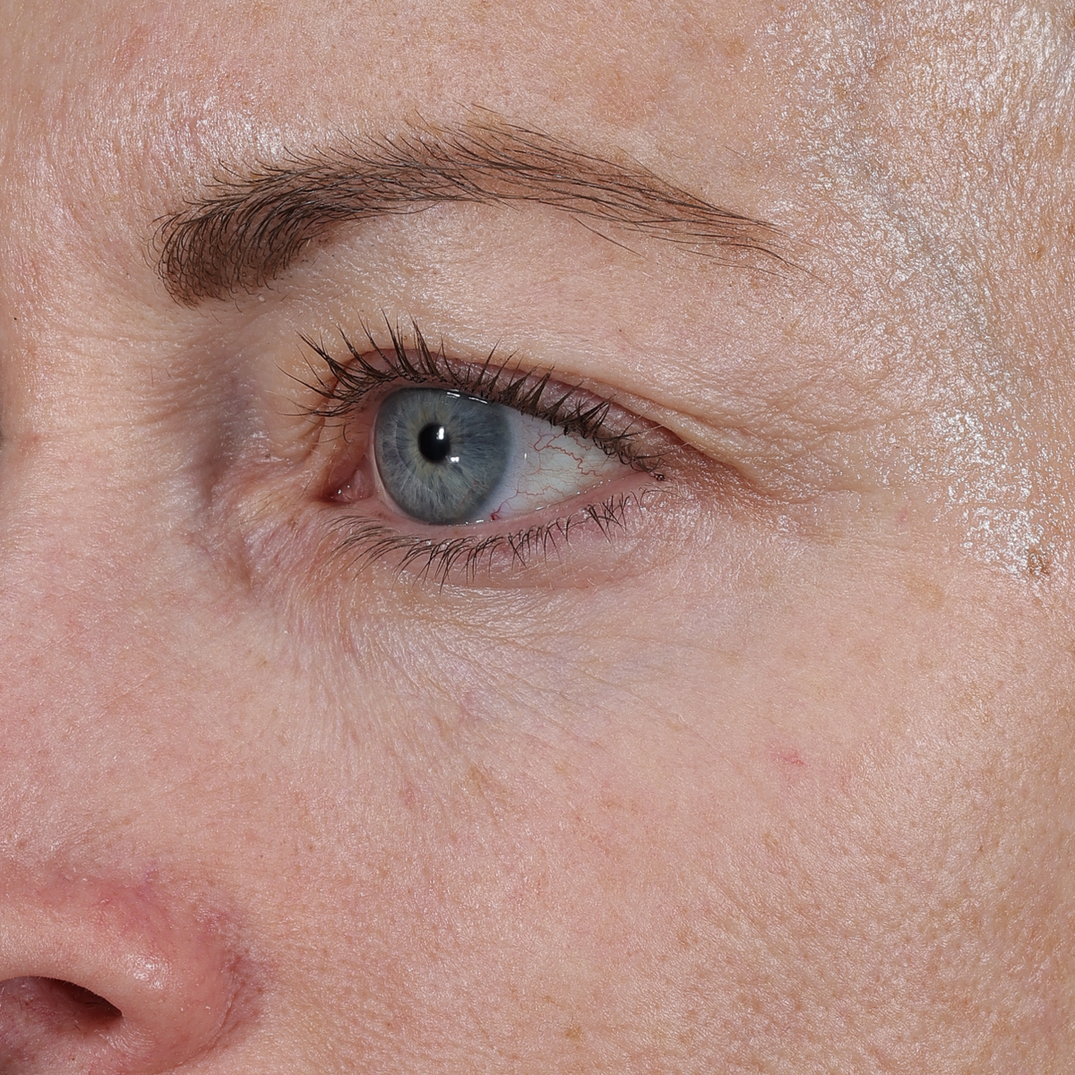 After 24 hours of Instant Angel: the same eye area looking smoother and plumper