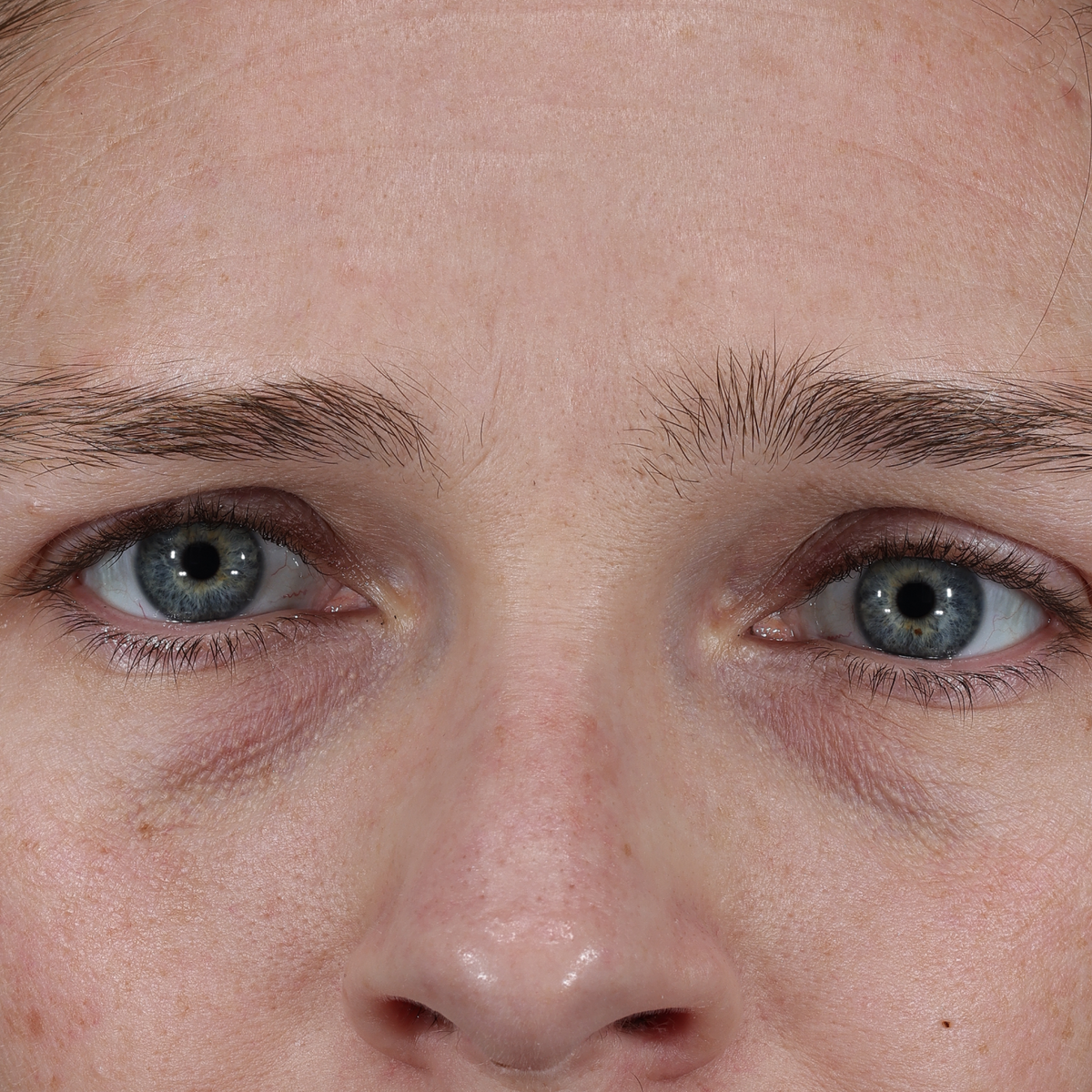 dieux Dieux-eyerepair-01.