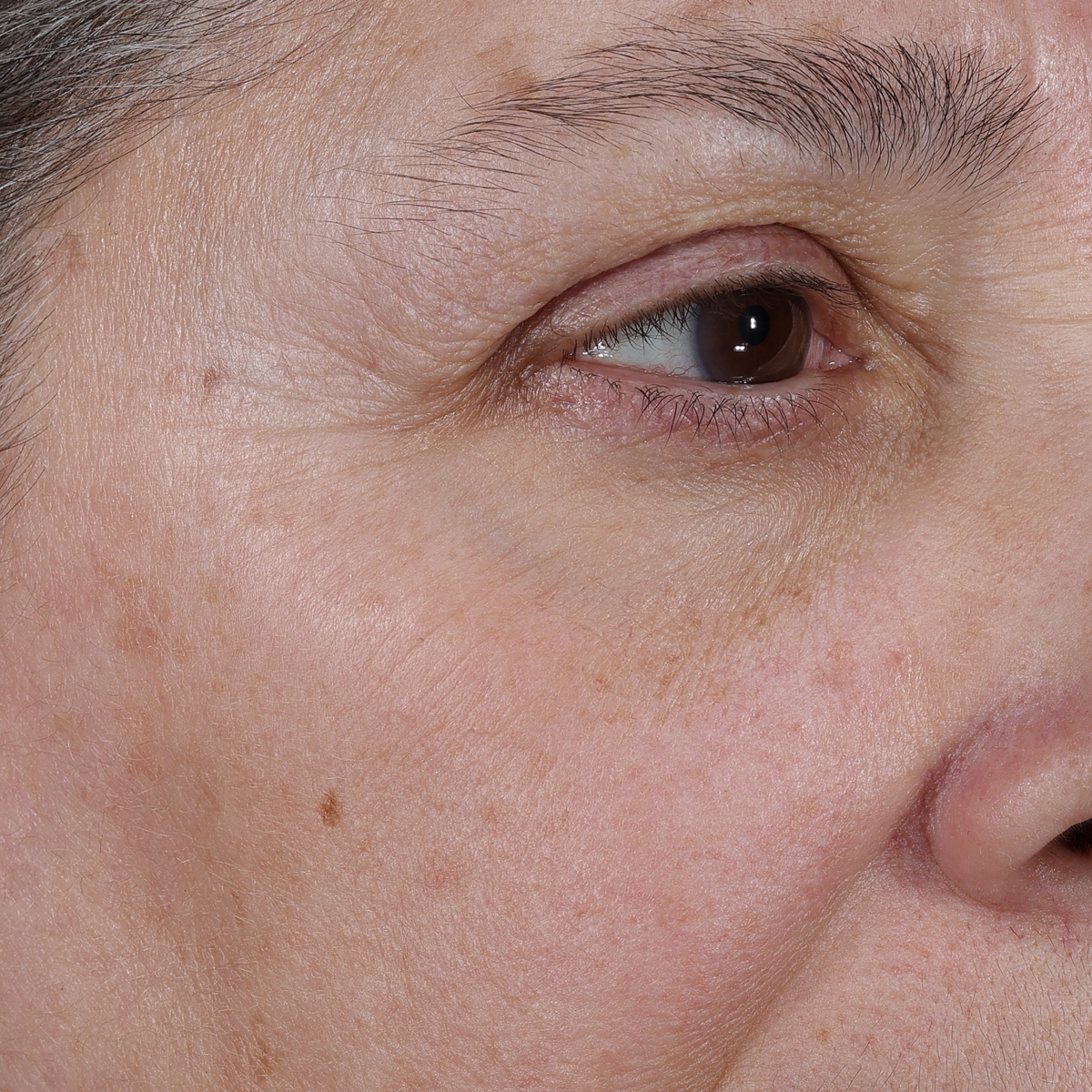 After 4 weeks of Deliverance: the same eye area with softer-looking fine lines and wrinkles