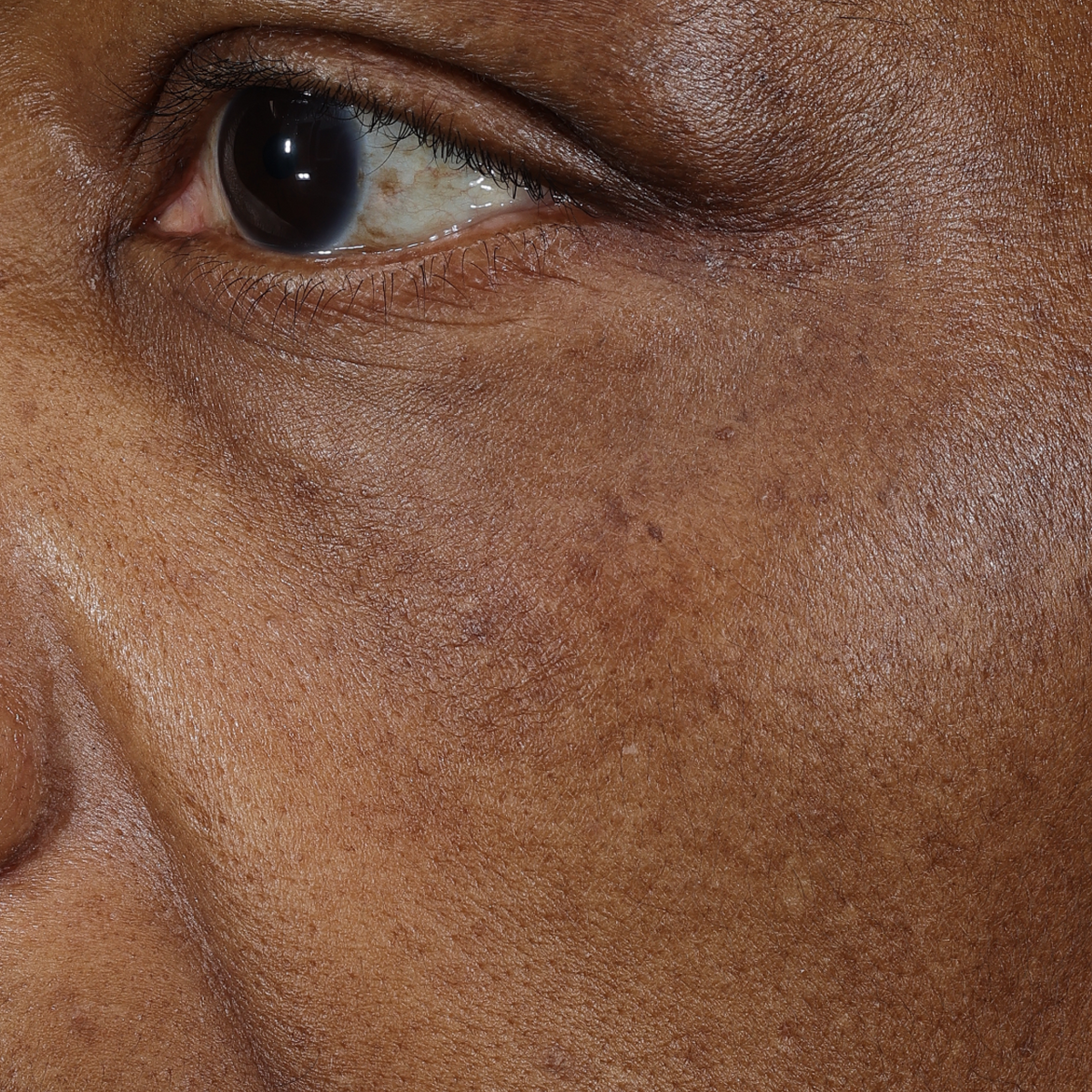 After 8 weeks of Deliverance: the same area with less visible age spots