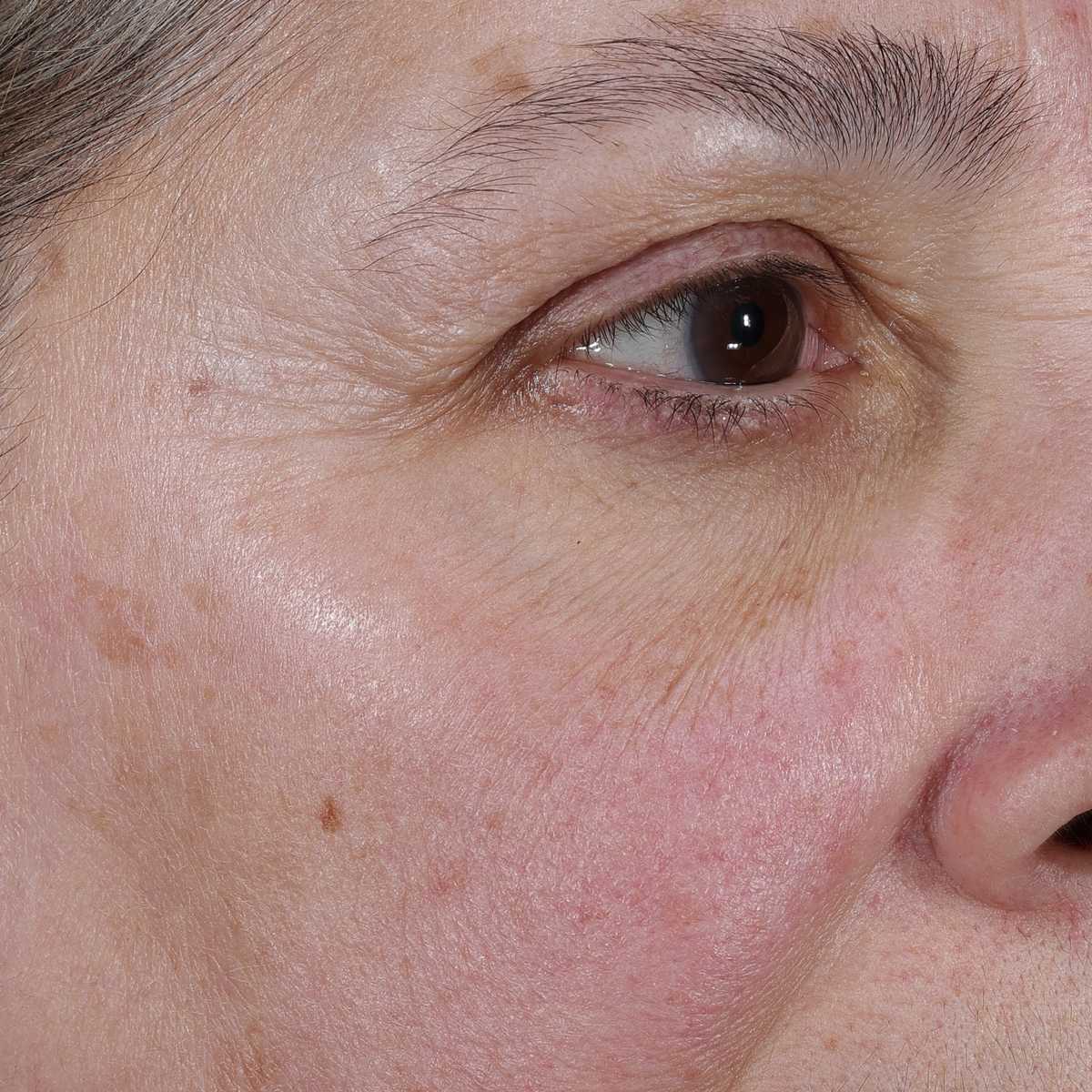 dieux Dieux-close-up-of-the-eye-area-of-an-older-person-with-visible-skin-texture-fine-lines-and-sun-spots-01.