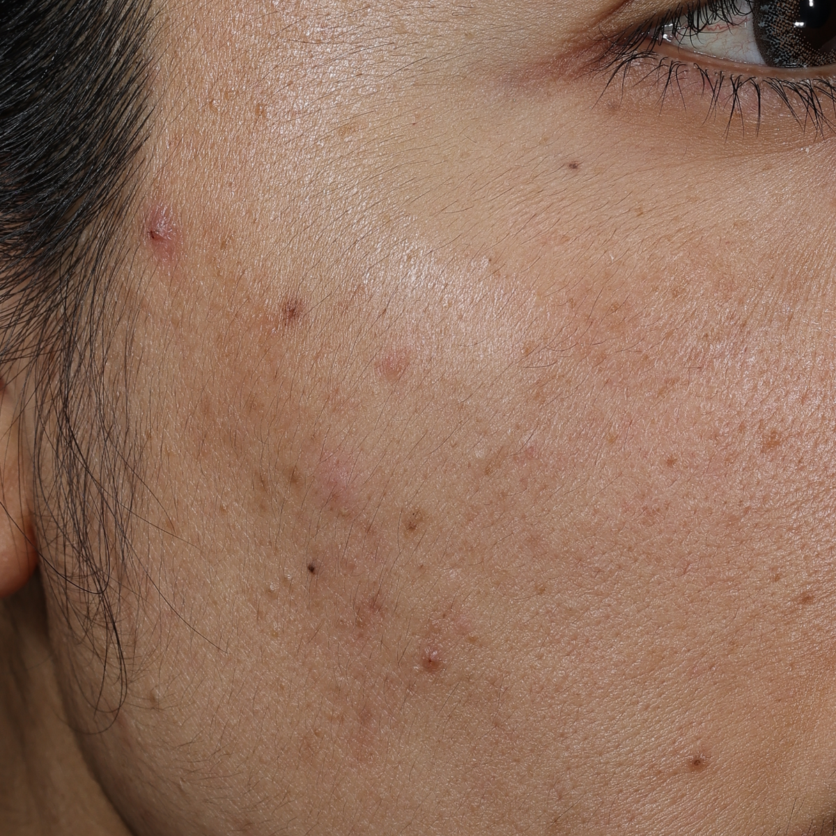 dieux Dieux-close-up-of-a-persons-cheek-showing-skin-texture-and-spots.